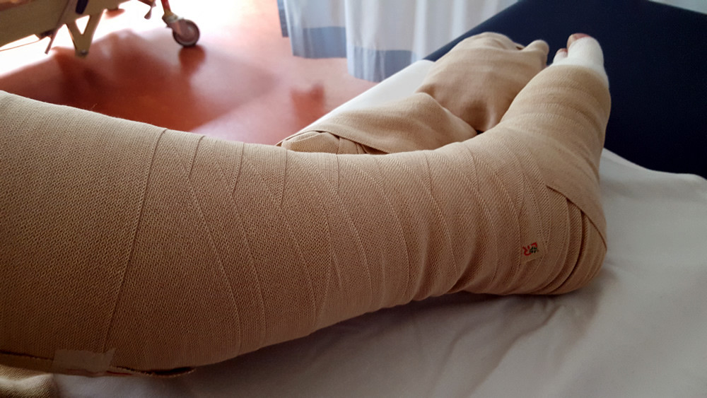 Wickel mit Kurzzug-Kompressionsbandagen in Achtertouren