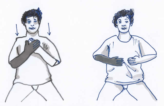 Lymphödem Gymnastikübung Arm und Schulter