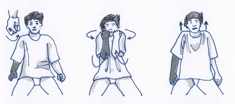 Lymphödem Gymnastikübung Arm und Schulter