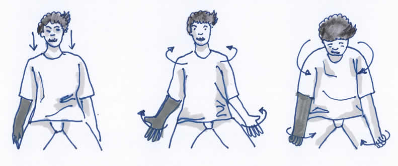 Lymphödem Gymnastikübung Arm und Schulter