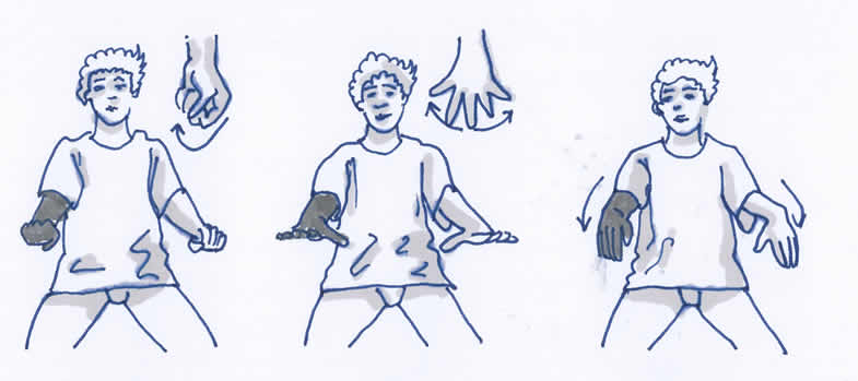 Lymphödem Gymnastikübung Arm und Schulter