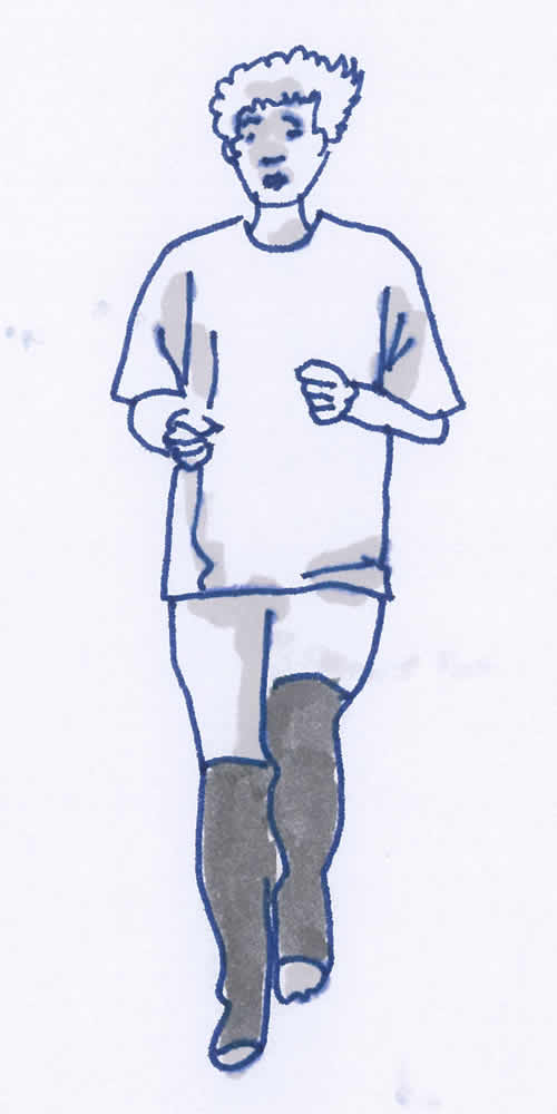 Gymnastikübung, Krankengymnastik Lymphödem Arm