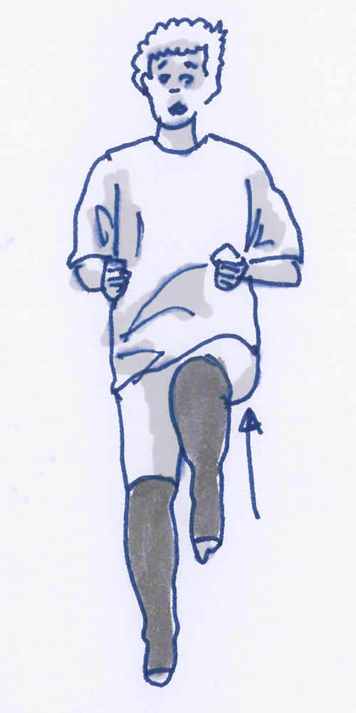 Gymnastikübung, Krankengymnastik Lymphödem Arm